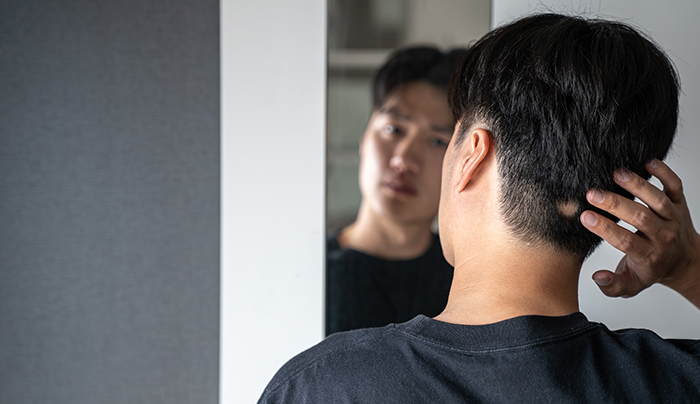 防脫髮產品推介：CAPILLUS激光活髮帽子真實案例